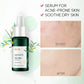 LAIKOU TEA TREE Face Serum Oil-control Anti-Aging Shrink Pores Acne Treatment Whitening Moisturizing Tea Tree Essence Skin Care