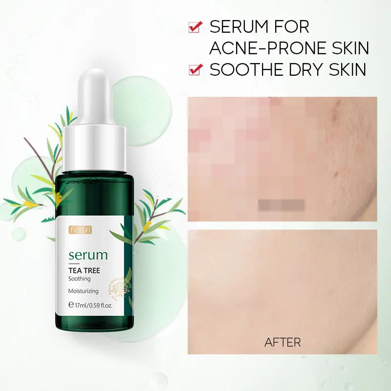 LAIKOU TEA TREE Face Serum Oil-control Anti-Aging Shrink Pores Acne Treatment Whitening Moisturizing Tea Tree Essence Skin Care