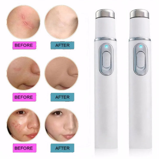 Blue Light Therapy Acne Pen Eye Massager Eye Beauty Device for Relax Eye Dark Circles Eye Bags Puffiness